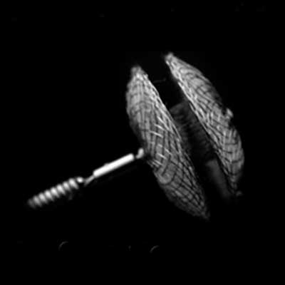 Oclusor Cocoon CIV — fechamento interventricular | Intermedical