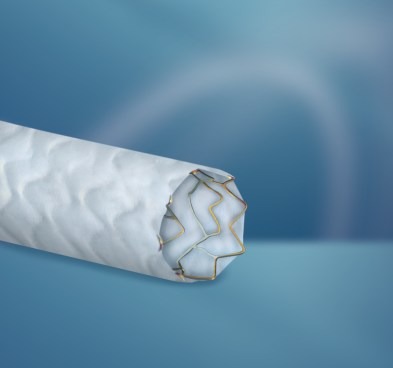 PK Papyrus – stent coronário recoberto Biotronik | Intermedical