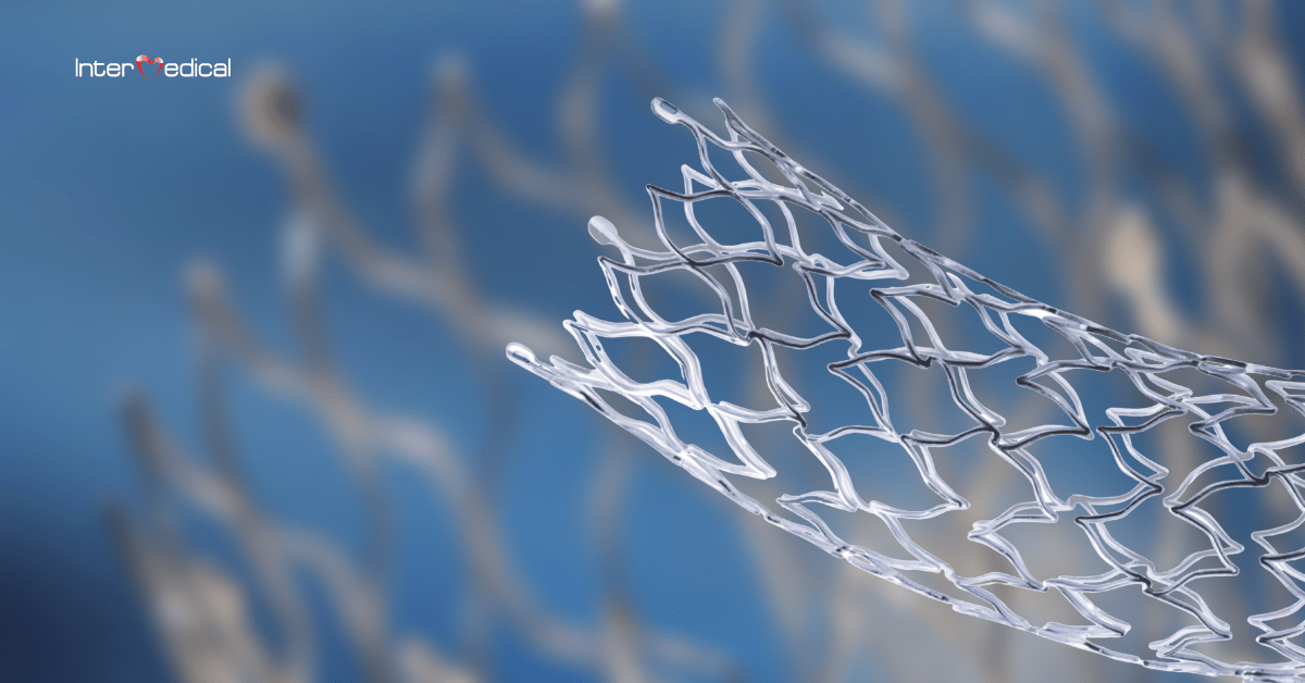 stent Sinus XL veia cava e aorta