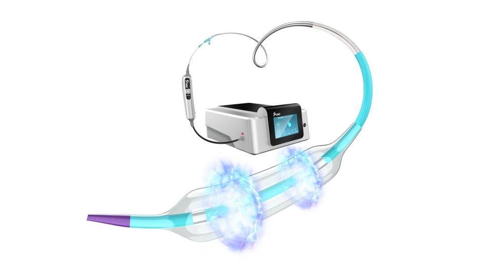 Vesscrack | Intermedical