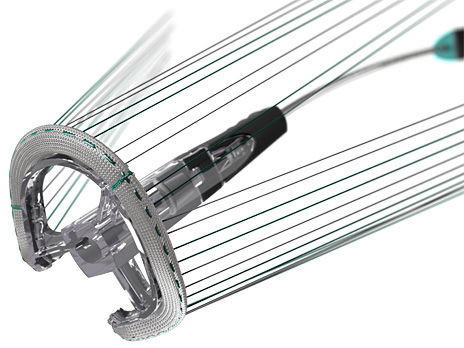 Physio Tricuspid Ring — Edwards Lifesciences